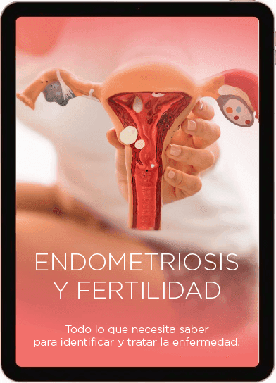 Endometriosis y Fertilidad